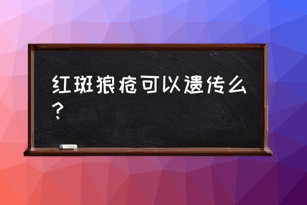 红斑狼疮会遗传给下一代吗 红斑狼疮可以遗传么？