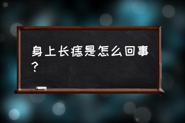 身上长痣是什么征兆 身上长痣是怎么回事？