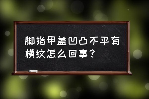 脚趾甲有凹凸横纹怎么回事 脚指甲盖凹凸不平有横纹怎么回事？