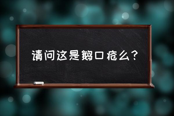 鹅口疮俗称叫什么 请问这是鹅口疮么？