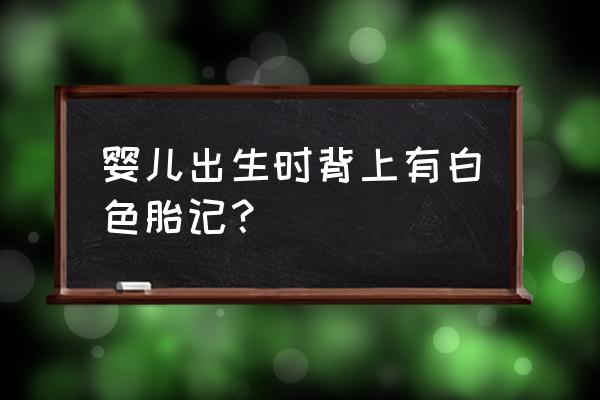 白色胎记和白斑的区别 婴儿出生时背上有白色胎记？