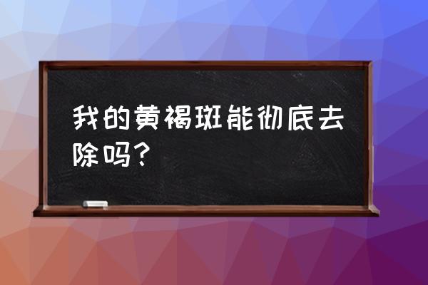 黄褐斑能彻底去除吗 我的黄褐斑能彻底去除吗？