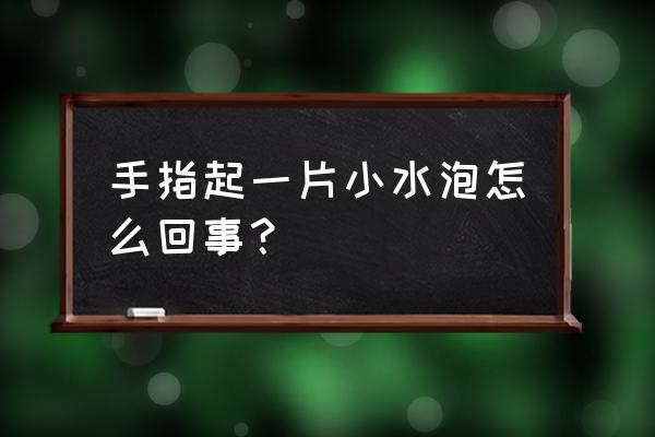 手指头起小水泡 手指起一片小水泡怎么回事？