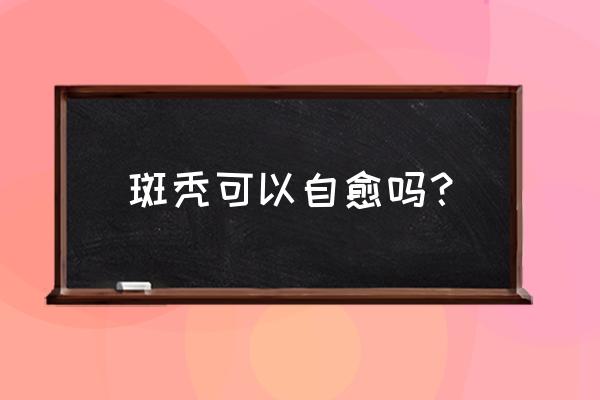 斑秃自然痊愈 斑秃可以自愈吗？