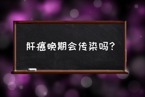 肝癌晚期会传染家属吗 肝癌晚期会传染吗？