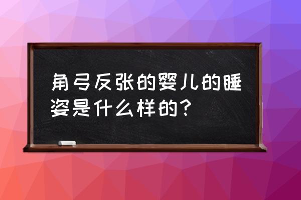 角弓反张姿势 角弓反张的婴儿的睡姿是什么样的？