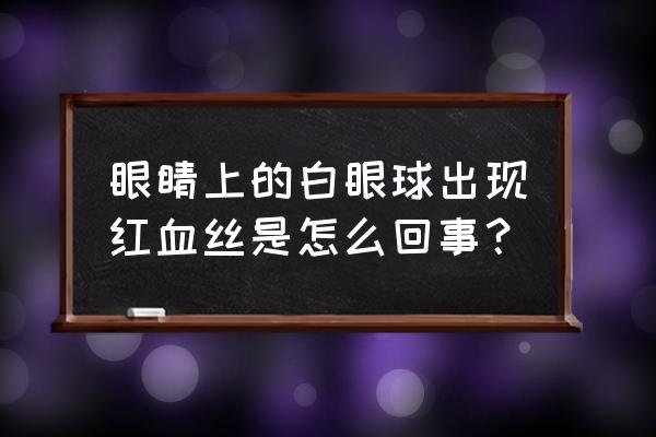 右眼眼白有红血丝 眼睛上的白眼球出现红血丝是怎么回事？