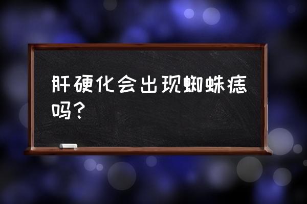 肝硬化出现蜘蛛痣的机制 肝硬化会出现蜘蛛痣吗？