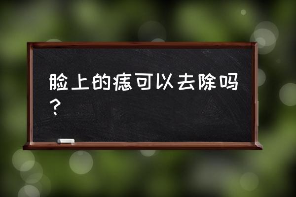 脸上的痣能随便去吗 脸上的痣可以去除吗？