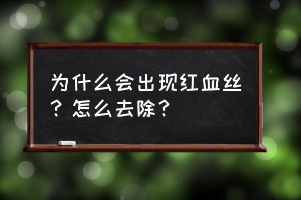 怎么快速消除红血丝 为什么会出现红血丝？怎么去除？