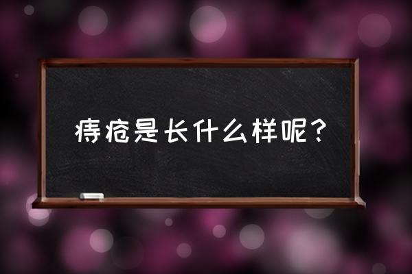 痔疮摸起来是什么样的 痔疮是长什么样呢？