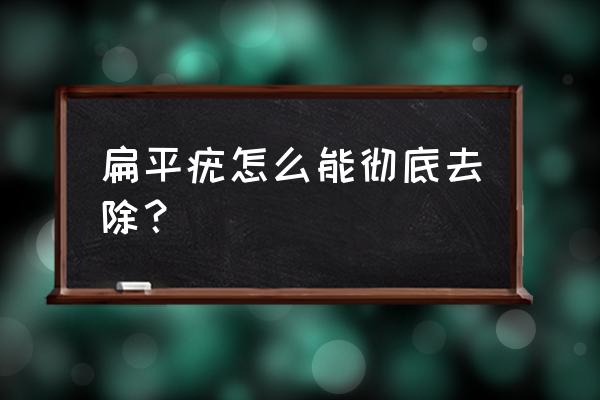 扁平疣怎么去除窍门 扁平疣怎么能彻底去除？