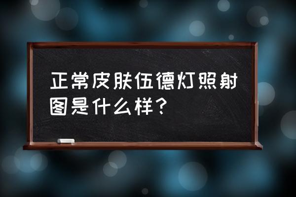 伍德氏灯能照人吗 正常皮肤伍德灯照射图是什么样？