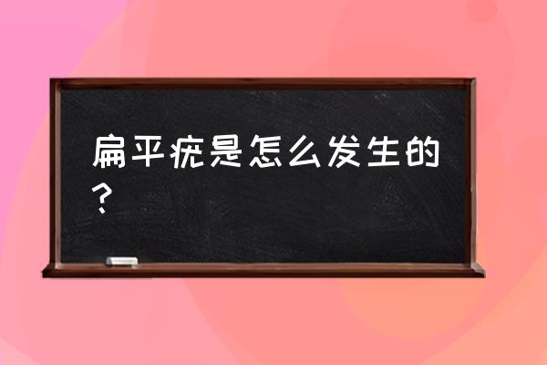 扁平疣是怎么引起的 扁平疣是怎么发生的？