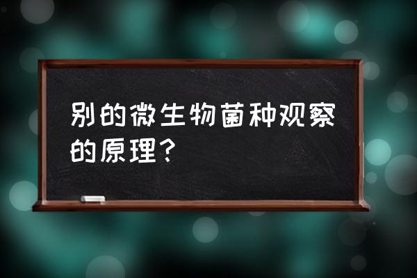 暗视野显微镜原理 别的微生物菌种观察的原理？