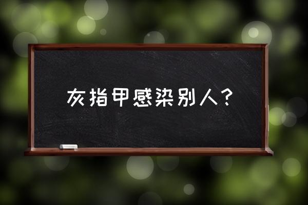 灰指甲很容易传染给别人吗 灰指甲感染别人？