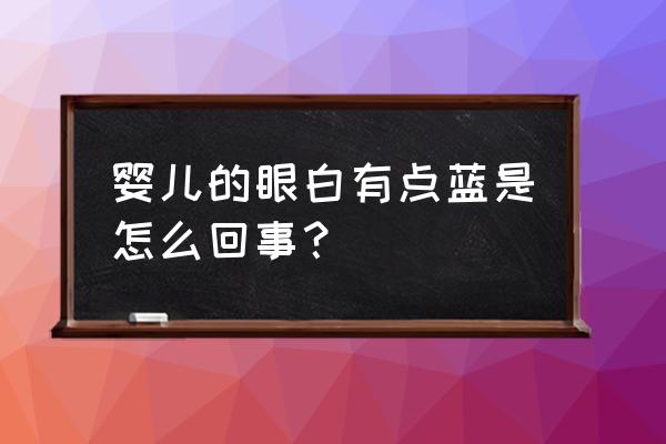 孩子白眼球发蓝 婴儿的眼白有点蓝是怎么回事？