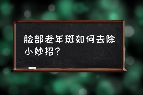 老年斑怎么去除掉 脸部老年斑如何去除小妙招？