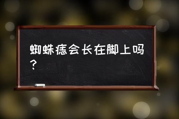 蜘蛛痣一般长在哪里 蜘蛛痣会长在脚上吗？