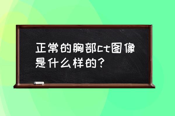 ct是什么样子的 正常的胸部ct图像是什么样的？