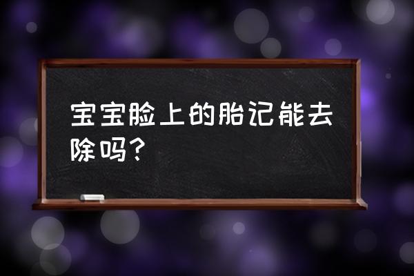 激光去胎记一次能做干净吗 宝宝脸上的胎记能去除吗？