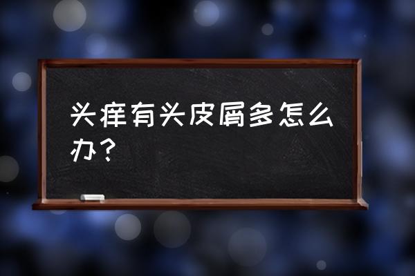 头皮发痒有头屑怎么办 头痒有头皮屑多怎么办？