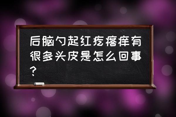 后脑勺起红疙瘩痒有很多头皮是怎么回事？ 后脑勺起红疙瘩痒有很多头皮是怎么回事？