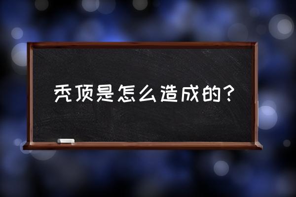 秃顶是怎么造成的？ 秃顶是怎么造成的？