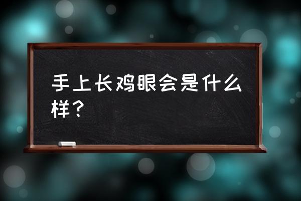 鸡眼是什么样的形状 手上长鸡眼会是什么样？