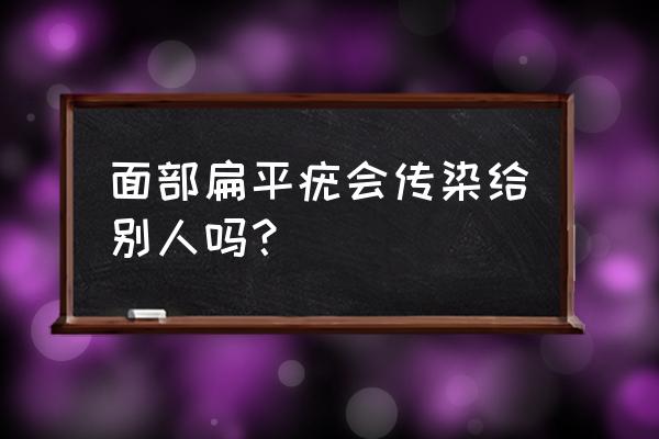 扁平疣传染给别人吗 面部扁平疣会传染给别人吗？