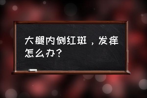 大腿内侧两边起红斑 大腿内侧红斑，发痒怎么办？