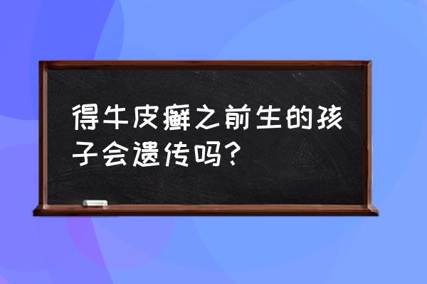 父亲有牛皮癣遗传吗 得牛皮癣之前生的孩子会遗传吗？