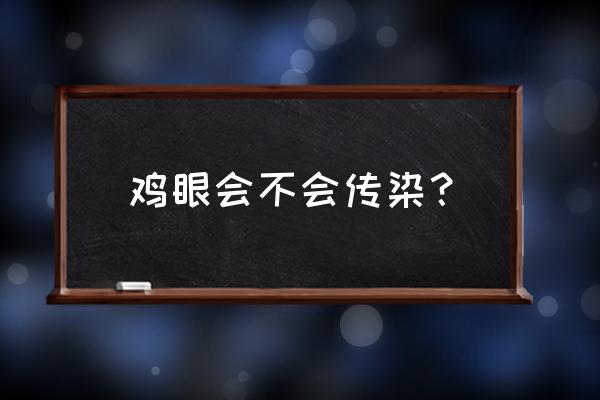 鸡眼会传染吗 鸡眼会不会传染？