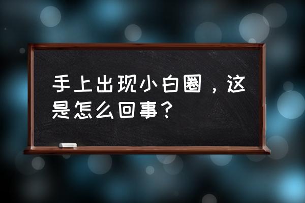 手上有白色的蜕皮小圈 手上出现小白圈，这是怎么回事？