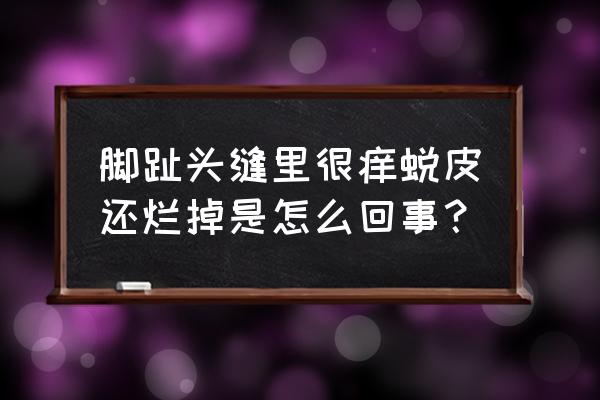 脚趾无缘无故发痒脱皮 脚趾头缝里很痒蜕皮还烂掉是怎么回事？