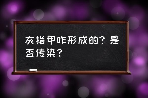 灰指甲什么情况下才会传染 灰指甲咋形成的？是否传染？