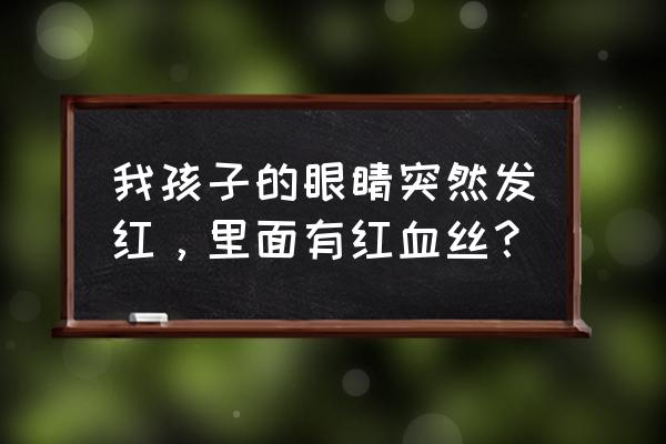 轻微红血丝怎么去除 我孩子的眼睛突然发红，里面有红血丝？