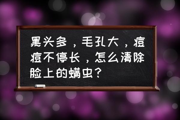 脸上螨虫痘痘去除方法 黑头多，毛孔大，痘痘不停长，怎么清除脸上的螨虫？