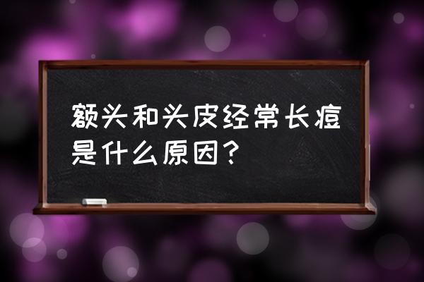 额头长痘的原因及调理方法 额头和头皮经常长痘是什么原因？