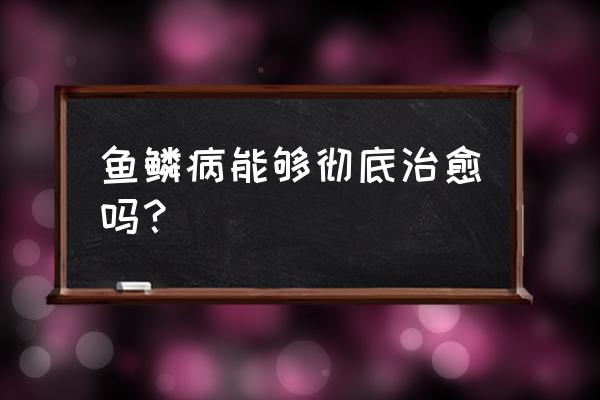 鱼鳞病怎么才能消除 鱼鳞病能够彻底治愈吗？