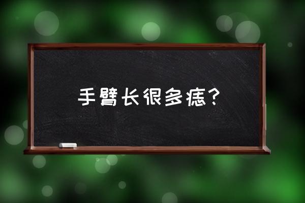 长在手臂上所有的痣图 手臂长很多痣？