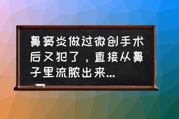 真菌性鼻窦炎千万不做手术 鼻窦炎做过微创手术后又犯了，直接从鼻子里流脓出来，还有异味，是怎么回事？