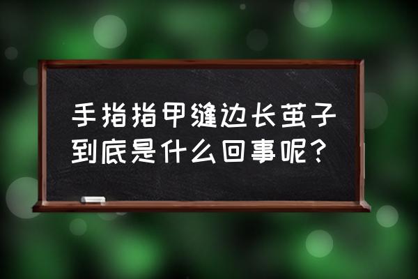 手指长硬疙瘩像茧不疼不痒 手指指甲缝边长茧子到底是什么回事呢？