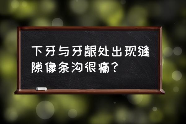 牙齿和牙龈之间有缝隙怎么办 下牙与牙龈处出现缝隙像条沟很痛？