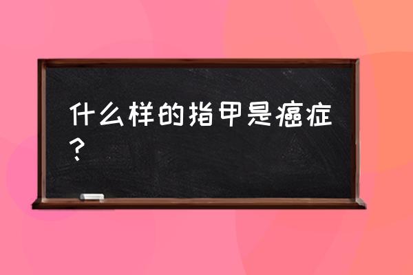 指甲黑色素瘤基本一眼就能看出来 什么样的指甲是癌症？