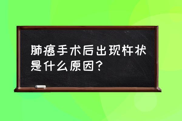 肺癌原因 肺癌手术后出现杵状是什么原因？