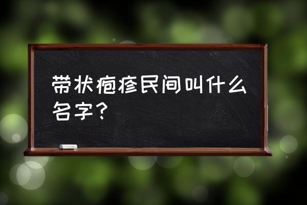 缠腰丹能自愈吗 带状疱疹民间叫什么名字？