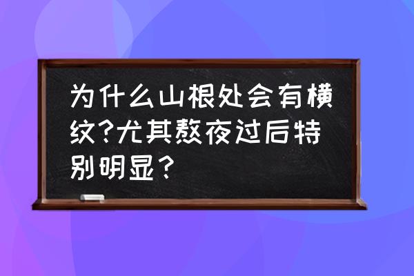 心脏不好鼻根横纹图片 为什么山根处会有横纹?尤其熬夜过后特别明显？