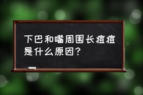 嘴巴周围跟下巴长痘痘什么原因 下巴和嘴周围长痘痘是什么原因？