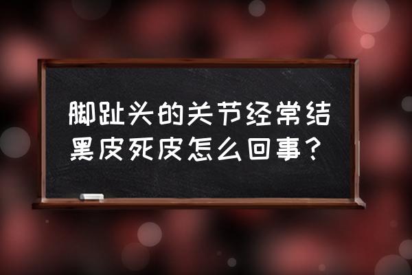 手指关节发黑要警惕 脚趾头的关节经常结黑皮死皮怎么回事？